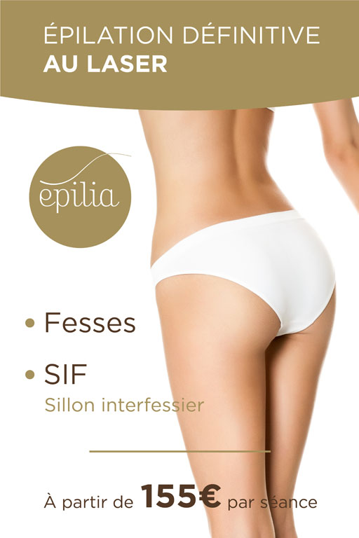 epilation-laser-fesses-sif-wavre-mob